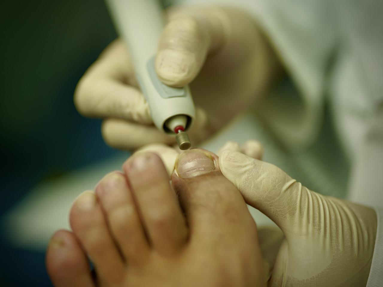 PEDICURE